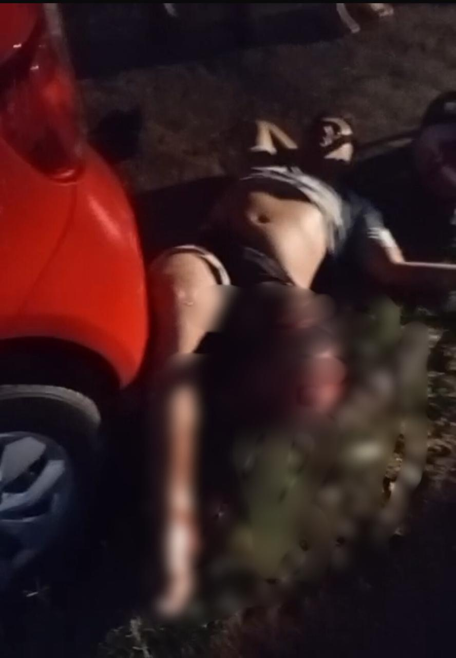 Acidentes de trânsito em Corumbá deixam motociclistas com fratura exposta e perna amputada na noite de domingo